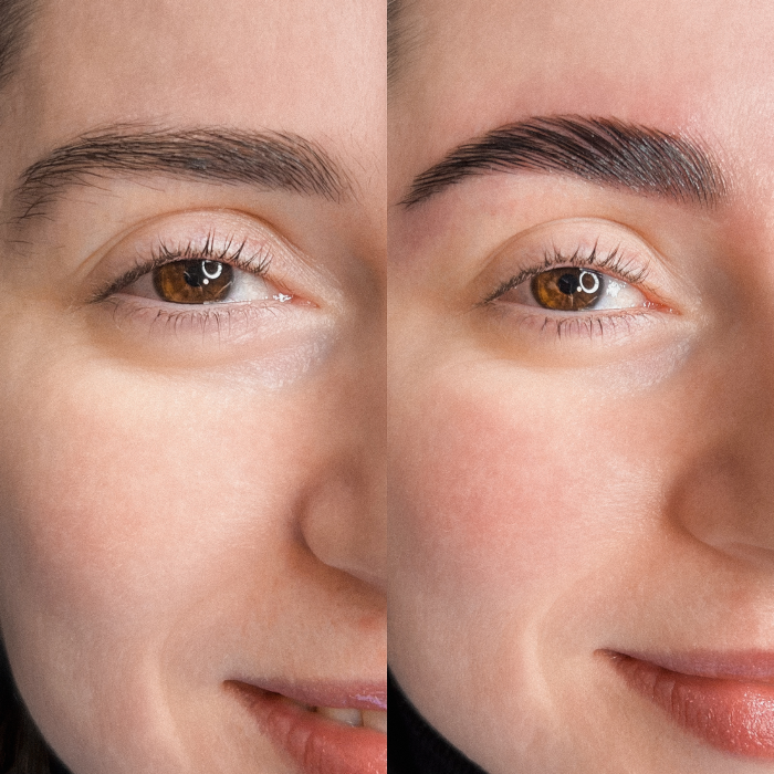 Brow Lamination