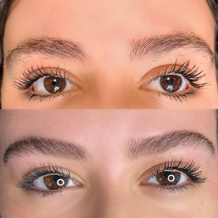 Brows Recovery Treatment
